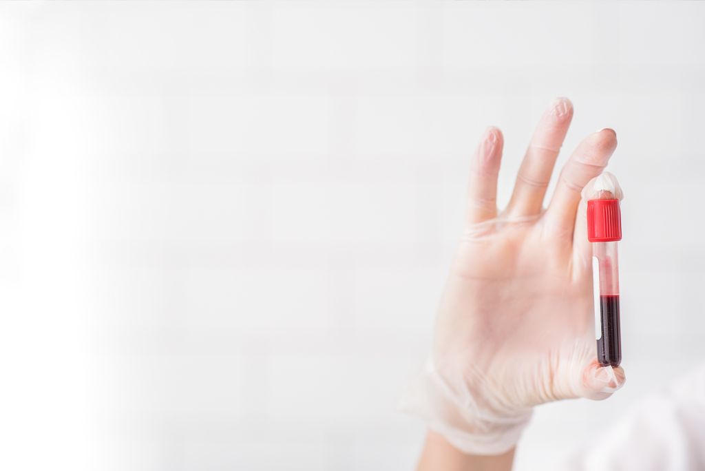 Trublood vérvétellel a daganatgyanú nyomában